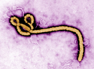 Ebola virus attacks the body's organs. It started in Western Africa and has infected three patients in the U.S.