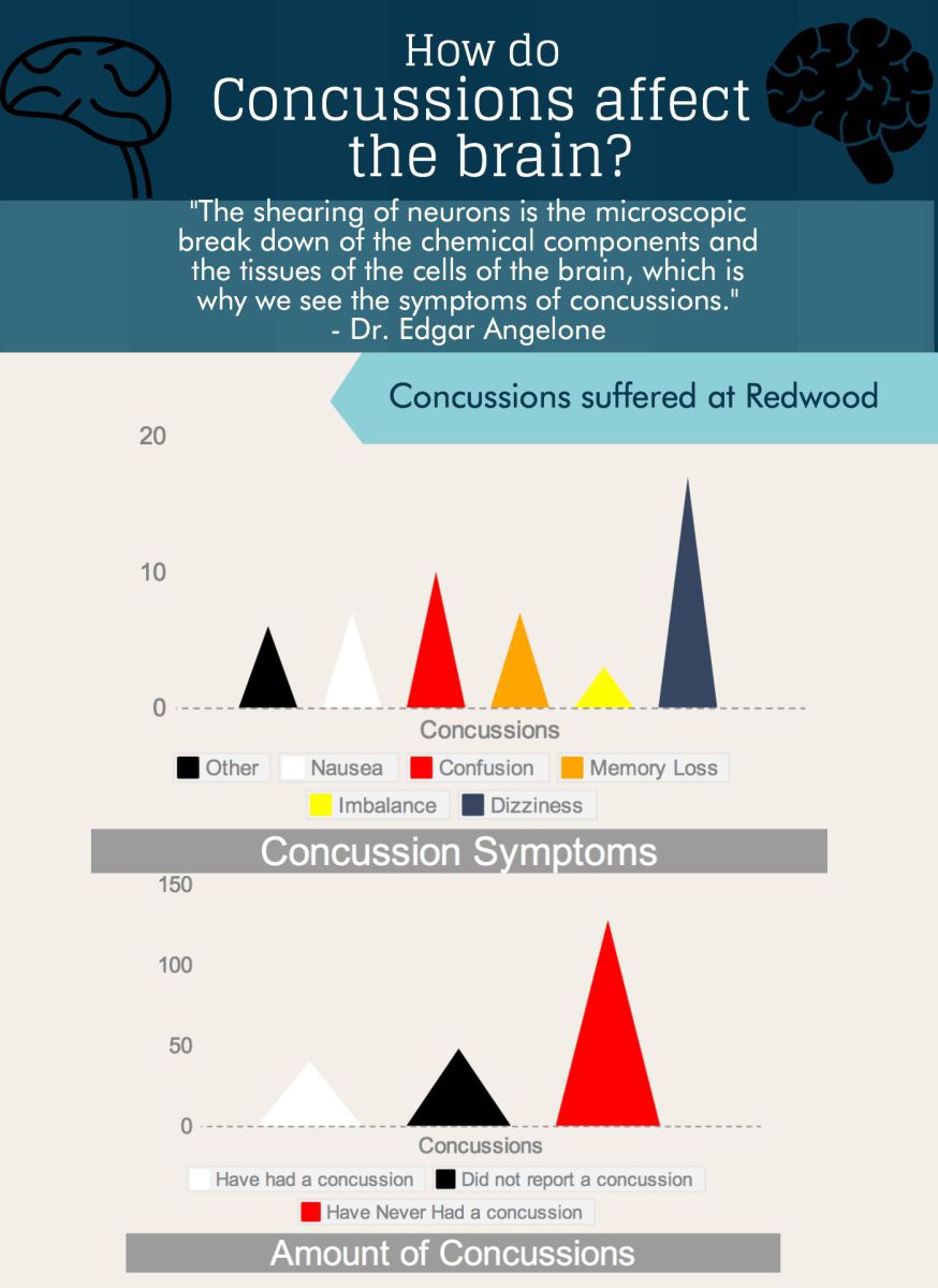 Concussions On The Rise In Youth And Professional Sports – Redwood Bark